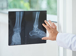 Unrecognizable medical practitioner examining X-ray picture of legs near window in doctor's office